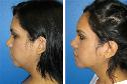 Before & After Photos